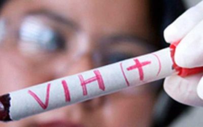 Nota en Perfil: Estudian a una paciente con VIH que logró una remisión completa