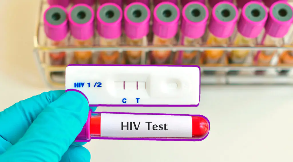 Mano con guante sostiene tubo de ensayo rotulado “HIV Test” frente a resultados de prueba.