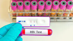 Mano con guante sostiene tubo de ensayo rotulado “HIV Test” frente a resultados de prueba.