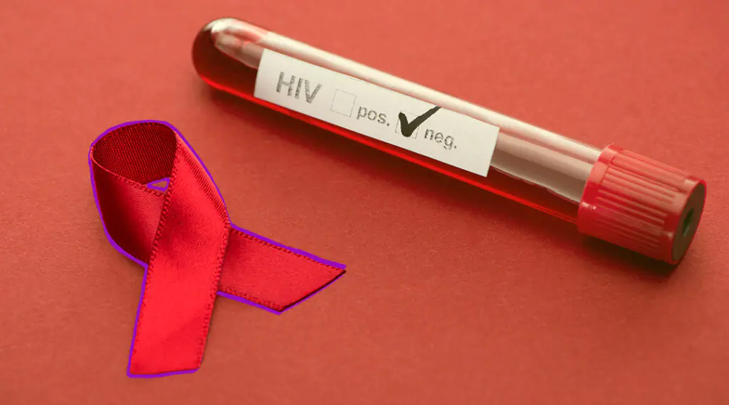 Tubo de ensayo rotulado HIV junto a lazo rojo, símbolo de concientización sobre el VIH.